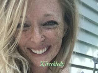 Xfreckledx